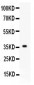 Anti-FGF1 Picoband Antibody